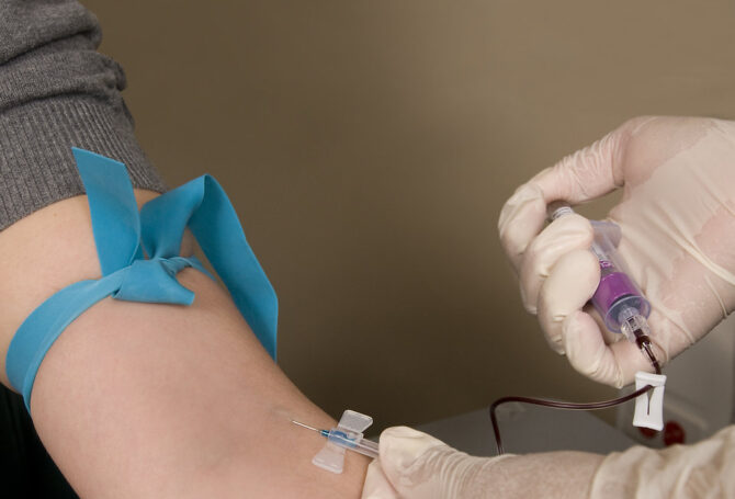 Image for How Phlebotomists Can Deal with Needle Phobia