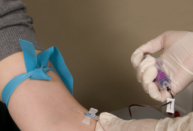 Image for How Phlebotomists Can Deal with Needle Phobia